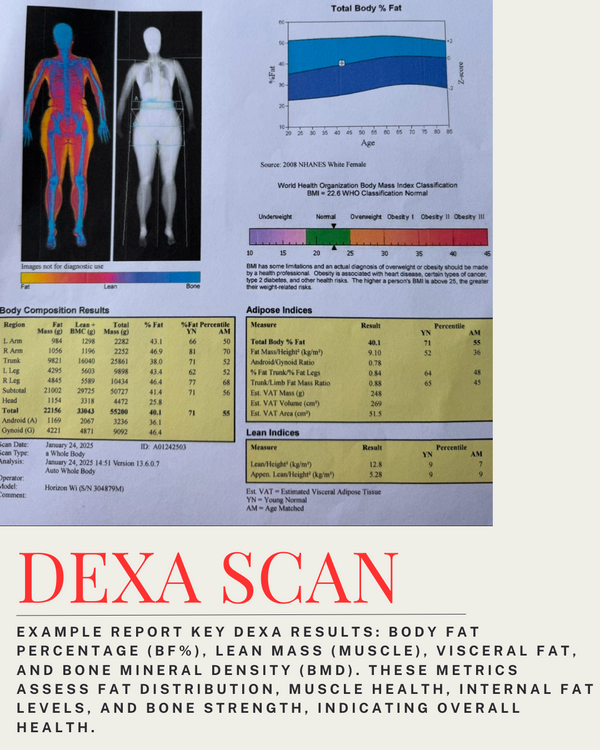 DEXA SCAN