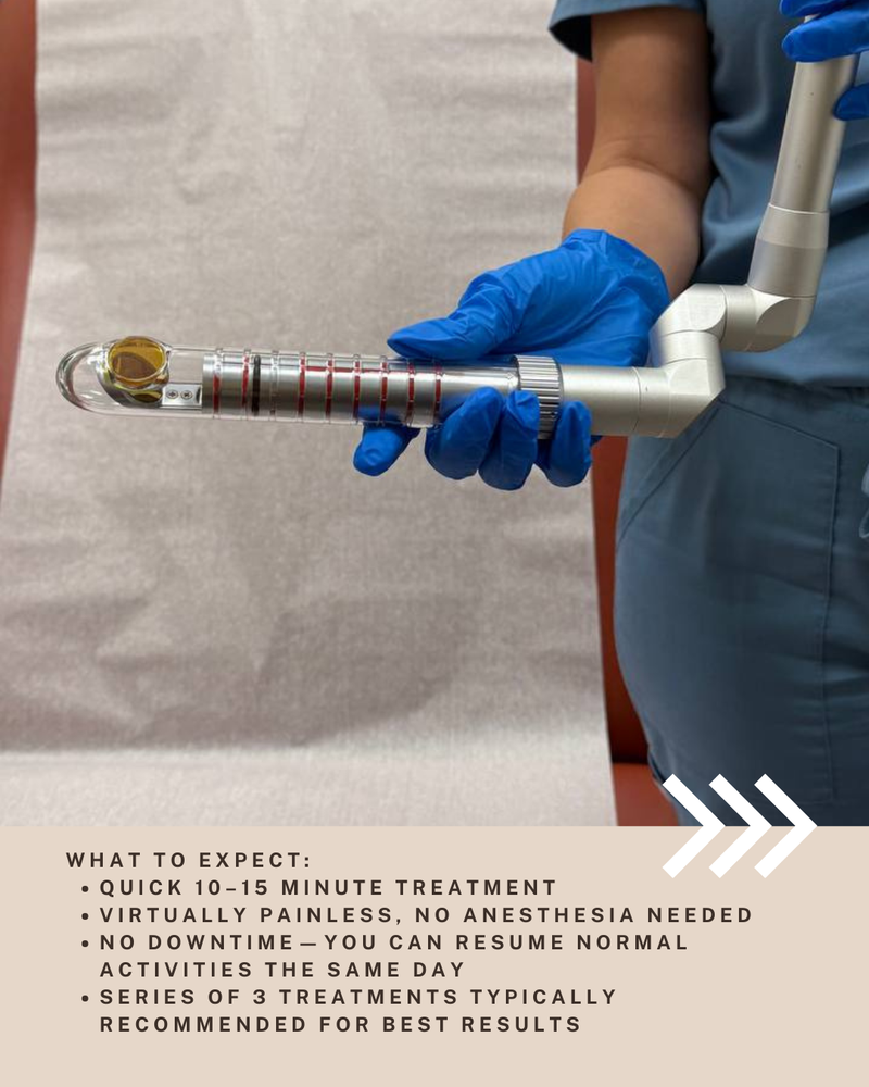 FemiLift Vaginal Rejuvenation